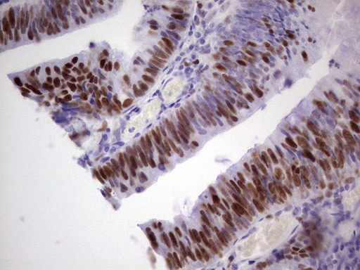 MCM2 Antibody in Immunohistochemistry (Paraffin) (IHC (P))