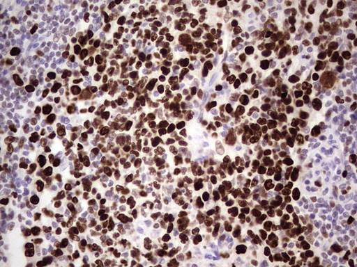 MCM2 Antibody in Immunohistochemistry (Paraffin) (IHC (P))