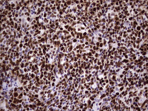 MCM2 Antibody in Immunohistochemistry (Paraffin) (IHC (P))