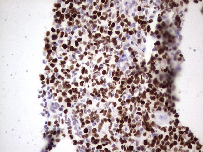 MCM2 Antibody in Immunohistochemistry (Paraffin) (IHC (P))