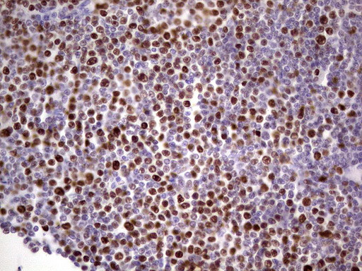 MCM2 Antibody in Immunohistochemistry (Paraffin) (IHC (P))