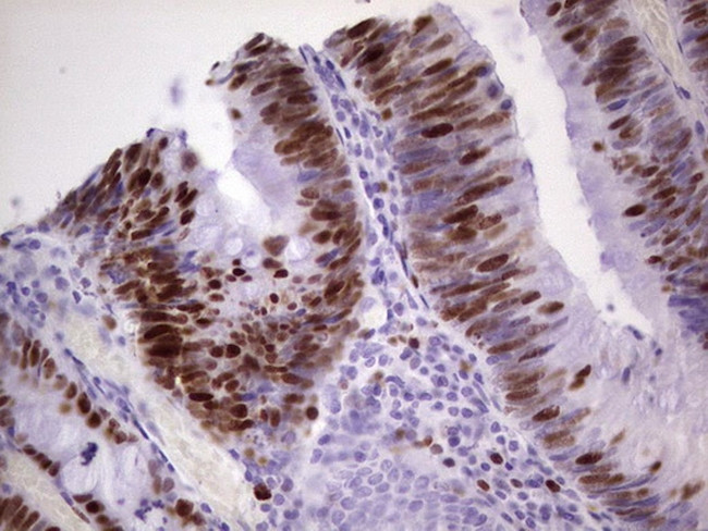 MCM2 Antibody in Immunohistochemistry (Paraffin) (IHC (P))