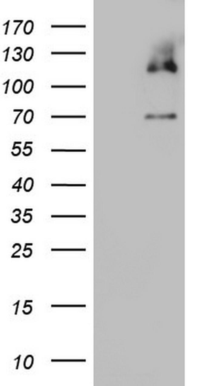 MCM2 Antibody in Western Blot (WB)