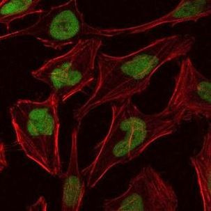 MCM2 Antibody in Immunocytochemistry (ICC/IF)