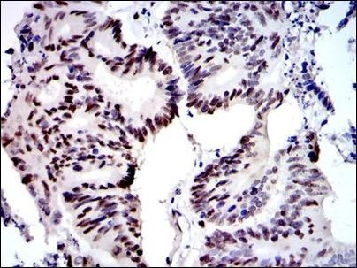 MCM2 Antibody in Immunohistochemistry (Paraffin) (IHC (P))