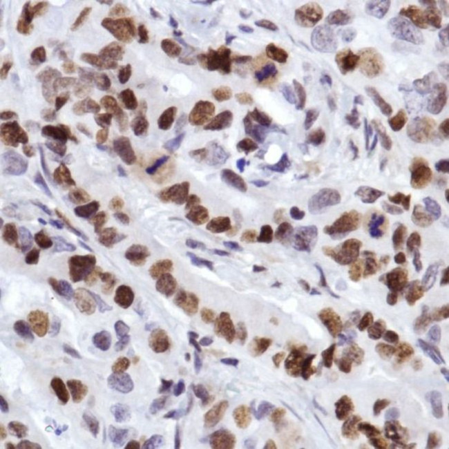 MCM2 Antibody in Immunohistochemistry (Paraffin) (IHC (P))