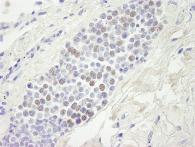 MCM4 Antibody in Immunohistochemistry (IHC)