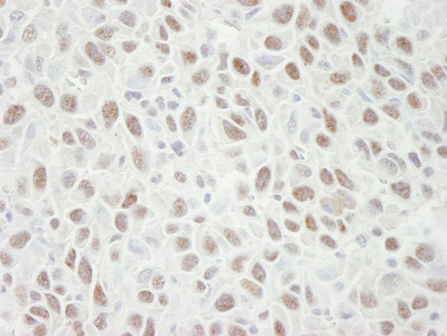 MCM4 Antibody in Immunohistochemistry (IHC)