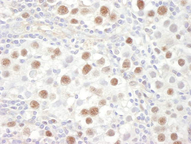 MCM4 Antibody in Immunohistochemistry (IHC)