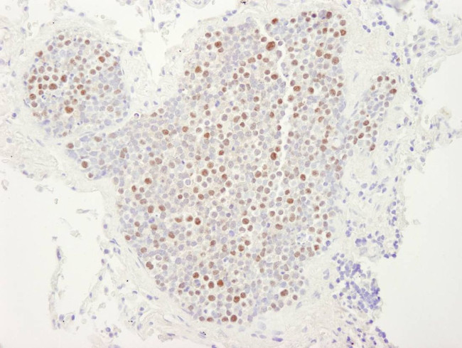 MCM4 Antibody in Immunohistochemistry (IHC)