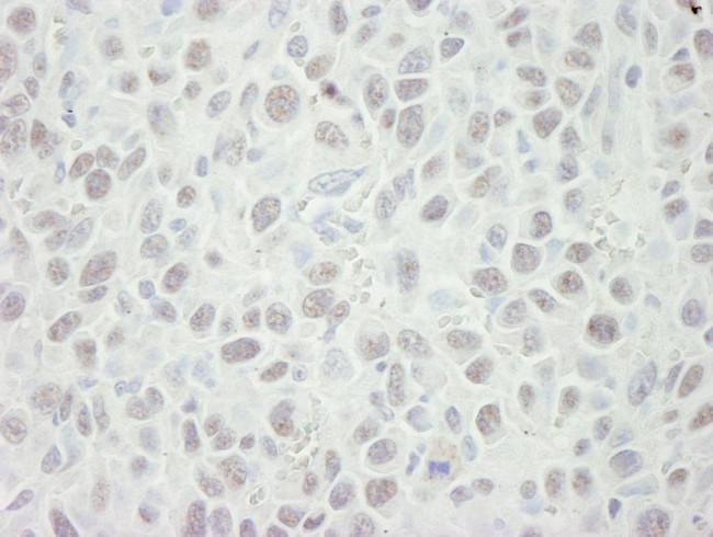 MCM5 Antibody in Immunohistochemistry (IHC)