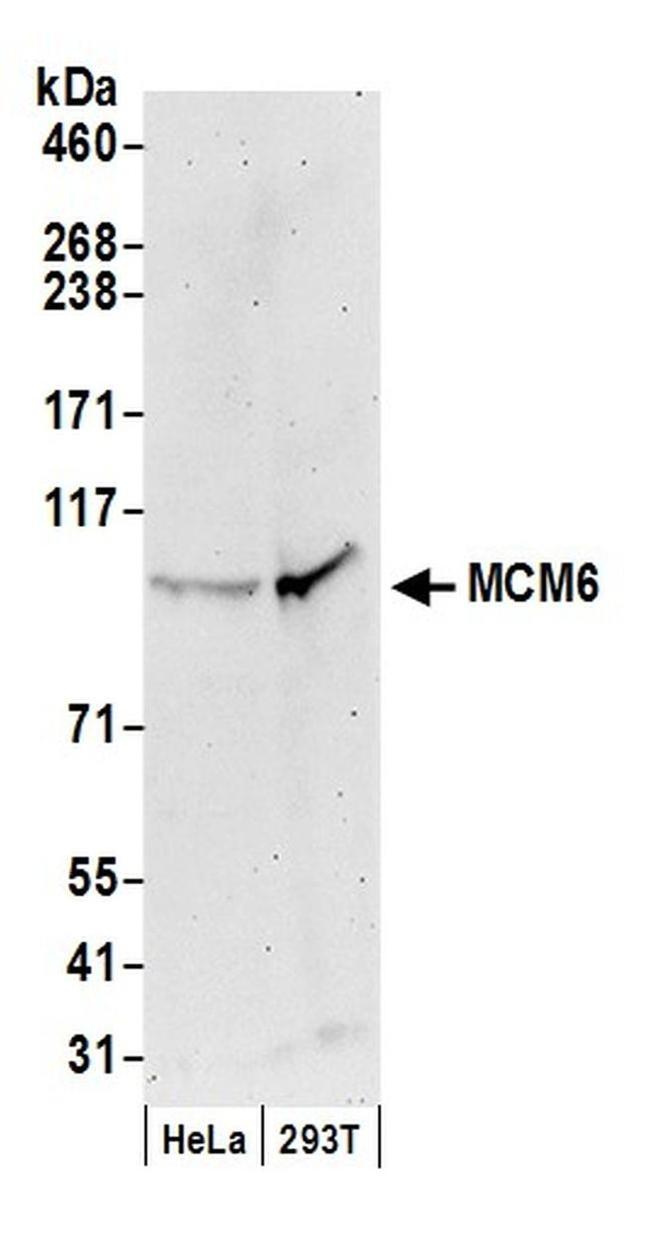 MCM6 Antibody in Western Blot (WB)