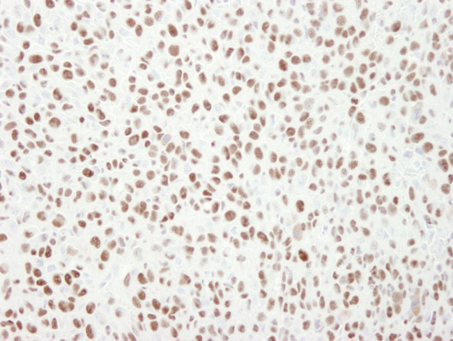 MCM6 Antibody in Immunohistochemistry (IHC)