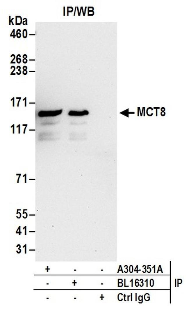 MCT8 Antibody in Western Blot (WB)