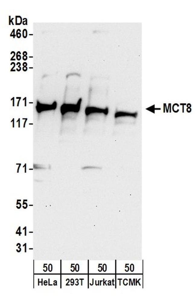 MCT8 Antibody in Western Blot (WB)