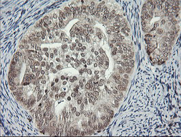 MCTS1 Antibody in Immunohistochemistry (Paraffin) (IHC (P))