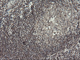 MCTS1 Antibody in Immunohistochemistry (Paraffin) (IHC (P))