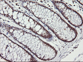 MCTS1 Antibody in Immunohistochemistry (Paraffin) (IHC (P))