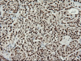 MCTS1 Antibody in Immunohistochemistry (Paraffin) (IHC (P))