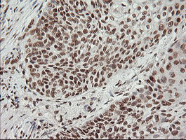 MCTS1 Antibody in Immunohistochemistry (Paraffin) (IHC (P))