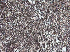 MCTS1 Antibody in Immunohistochemistry (Paraffin) (IHC (P))