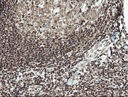 MCTS1 Antibody in Immunohistochemistry (Paraffin) (IHC (P))