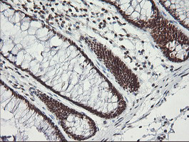 MCTS1 Antibody in Immunohistochemistry (Paraffin) (IHC (P))