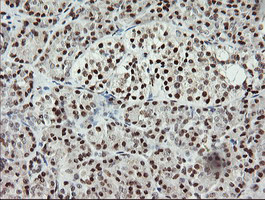 MCTS1 Antibody in Immunohistochemistry (Paraffin) (IHC (P))