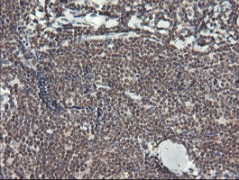 MCTS1 Antibody in Immunohistochemistry (Paraffin) (IHC (P))