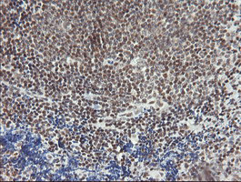 MCTS1 Antibody in Immunohistochemistry (Paraffin) (IHC (P))