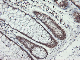 MCTS1 Antibody in Immunohistochemistry (Paraffin) (IHC (P))