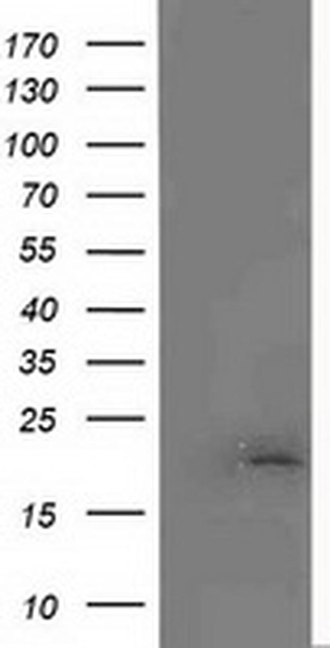 MCTS1 Antibody in Western Blot (WB)