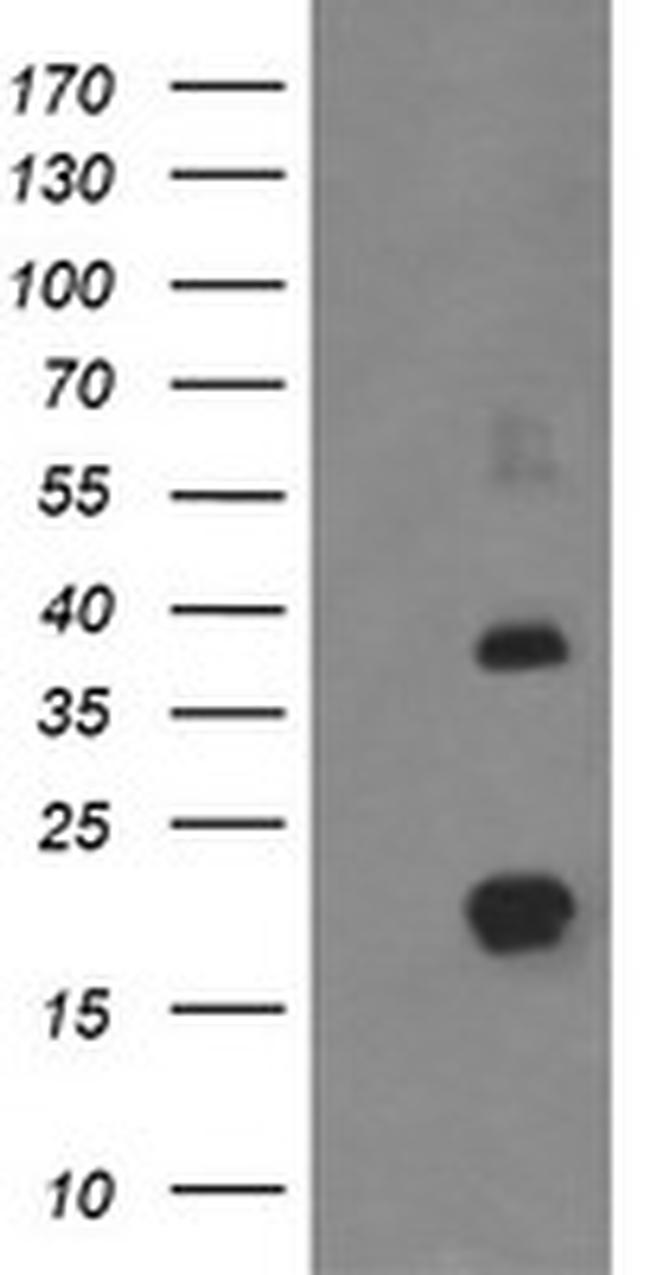 MCTS1 Antibody in Western Blot (WB)