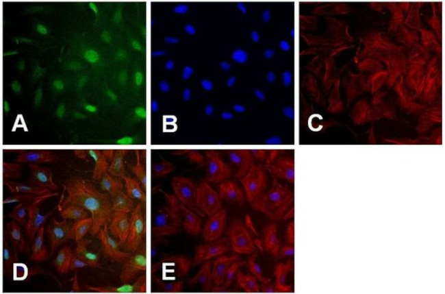 MDM2 Antibody in Immunocytochemistry (ICC/IF)