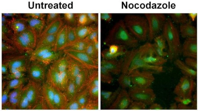 MDM2 Antibody in Immunocytochemistry (ICC/IF)