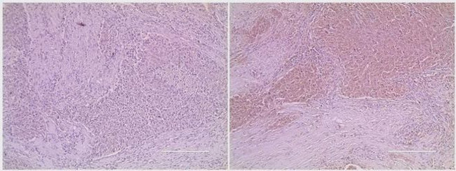 MDM2 Antibody in Immunohistochemistry (Paraffin) (IHC (P))