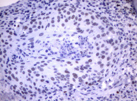 MDM2 Antibody in Immunohistochemistry (Paraffin) (IHC (P))