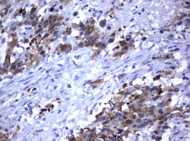 MDM2 Antibody in Immunohistochemistry (Paraffin) (IHC (P))