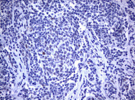 MDM2 Antibody in Immunohistochemistry (Paraffin) (IHC (P))