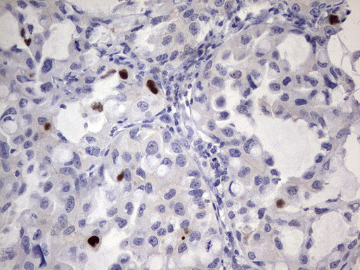 MDM2 Antibody in Immunohistochemistry (Paraffin) (IHC (P))