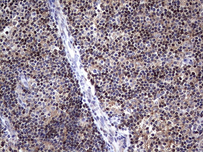 MDM2 Antibody in Immunohistochemistry (Paraffin) (IHC (P))