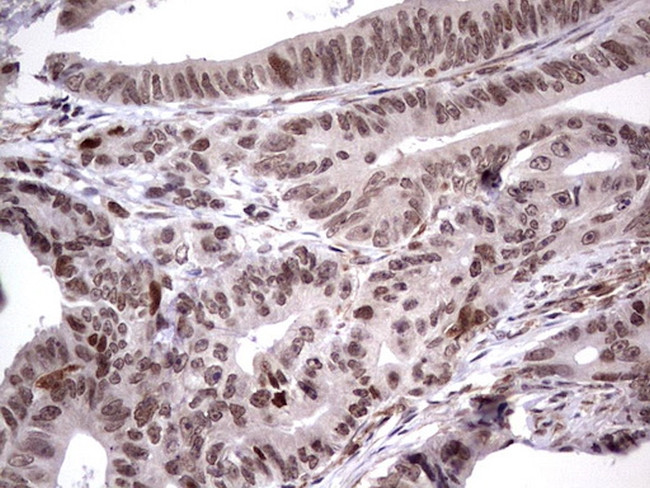 MDM2 Antibody in Immunohistochemistry (Paraffin) (IHC (P))