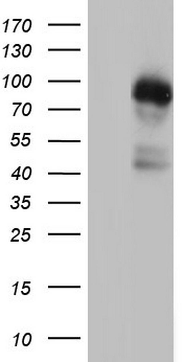 MDM2 Antibody in Western Blot (WB)