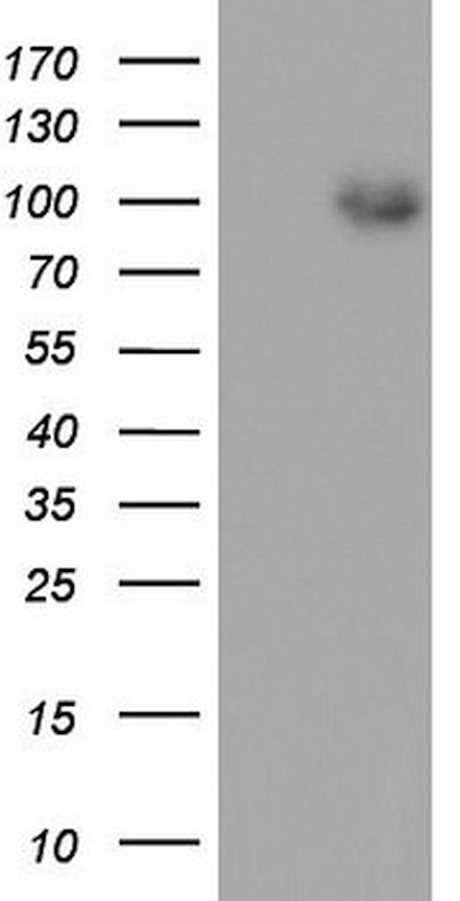 MDM2 Antibody in Western Blot (WB)