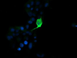 MDM4 Antibody in Immunocytochemistry (ICC/IF)