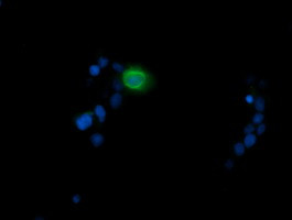 MDM4 Antibody in Immunocytochemistry (ICC/IF)