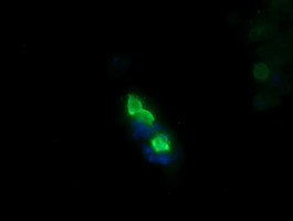 MDM4 Antibody in Immunocytochemistry (ICC/IF)