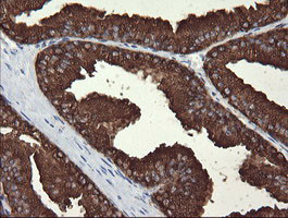 MDM4 Antibody in Immunohistochemistry (Paraffin) (IHC (P))