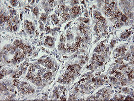 MDM4 Antibody in Immunohistochemistry (Paraffin) (IHC (P))