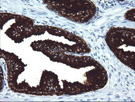 MDM4 Antibody in Immunohistochemistry (Paraffin) (IHC (P))